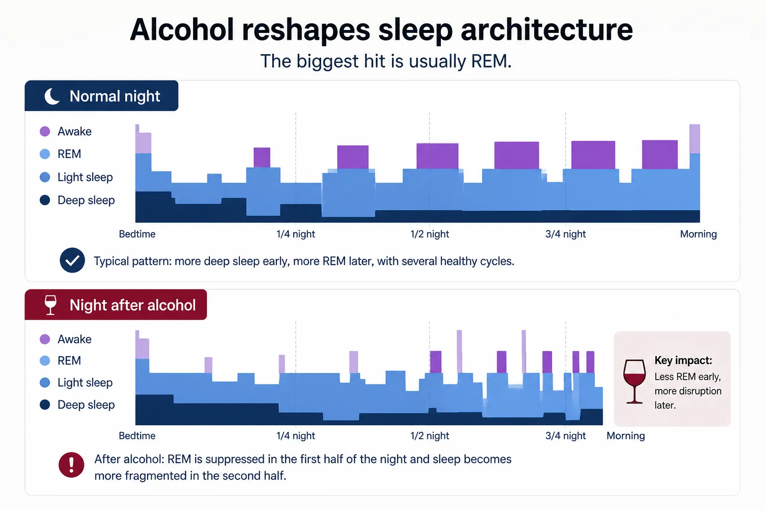 Sleep stages before and after alcohol Sleep-stage charts comparing a normal night with a night after alcohol, showing reduced REM and more awakenings.